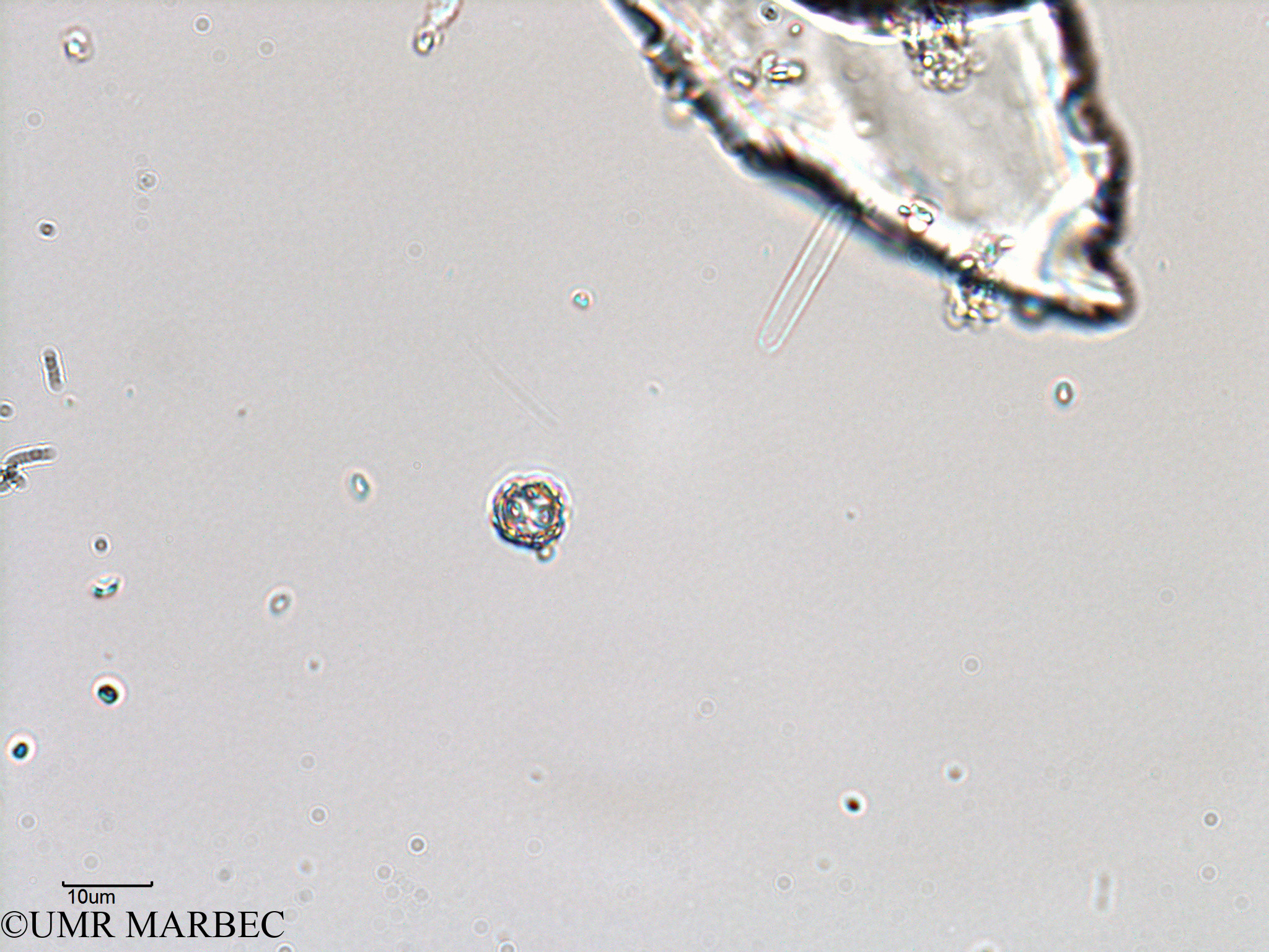 phyto/Bizerte/bizerte_bay/RISCO February 2015/Coccolithophoride 7 (ancien Baie_T5-C2-Coccolitho spp-8).tif(copy).jpg